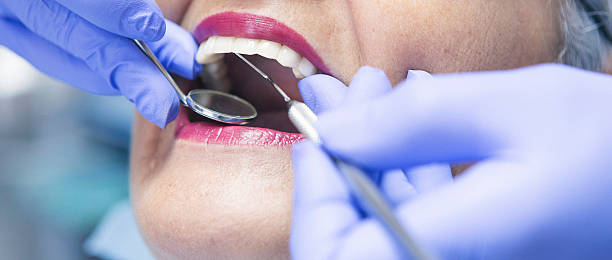 Best Mobile Emergency Dentist in Royse City, TX